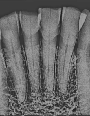 Anthropology faculty member, student use emerging technique to determine age of skulls